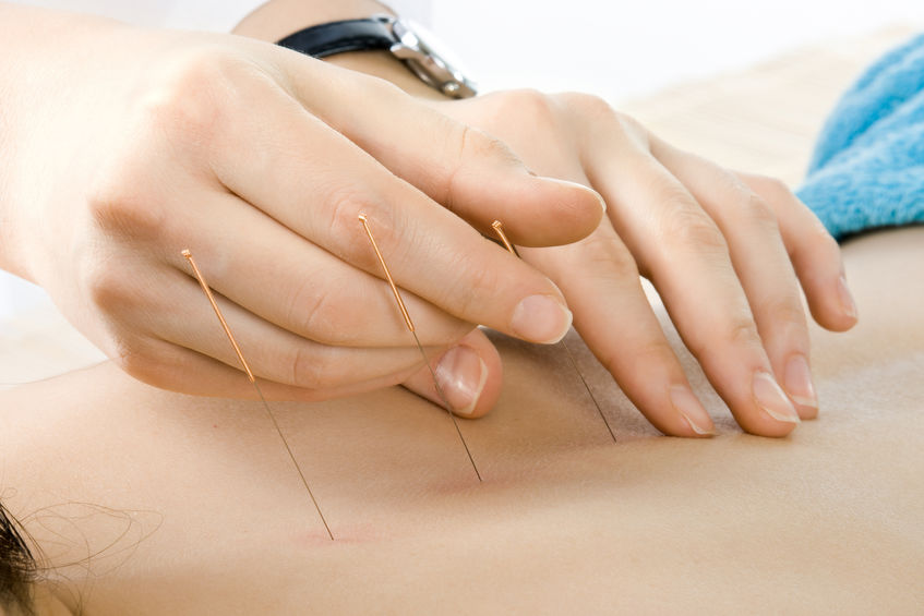 effets acupuncture